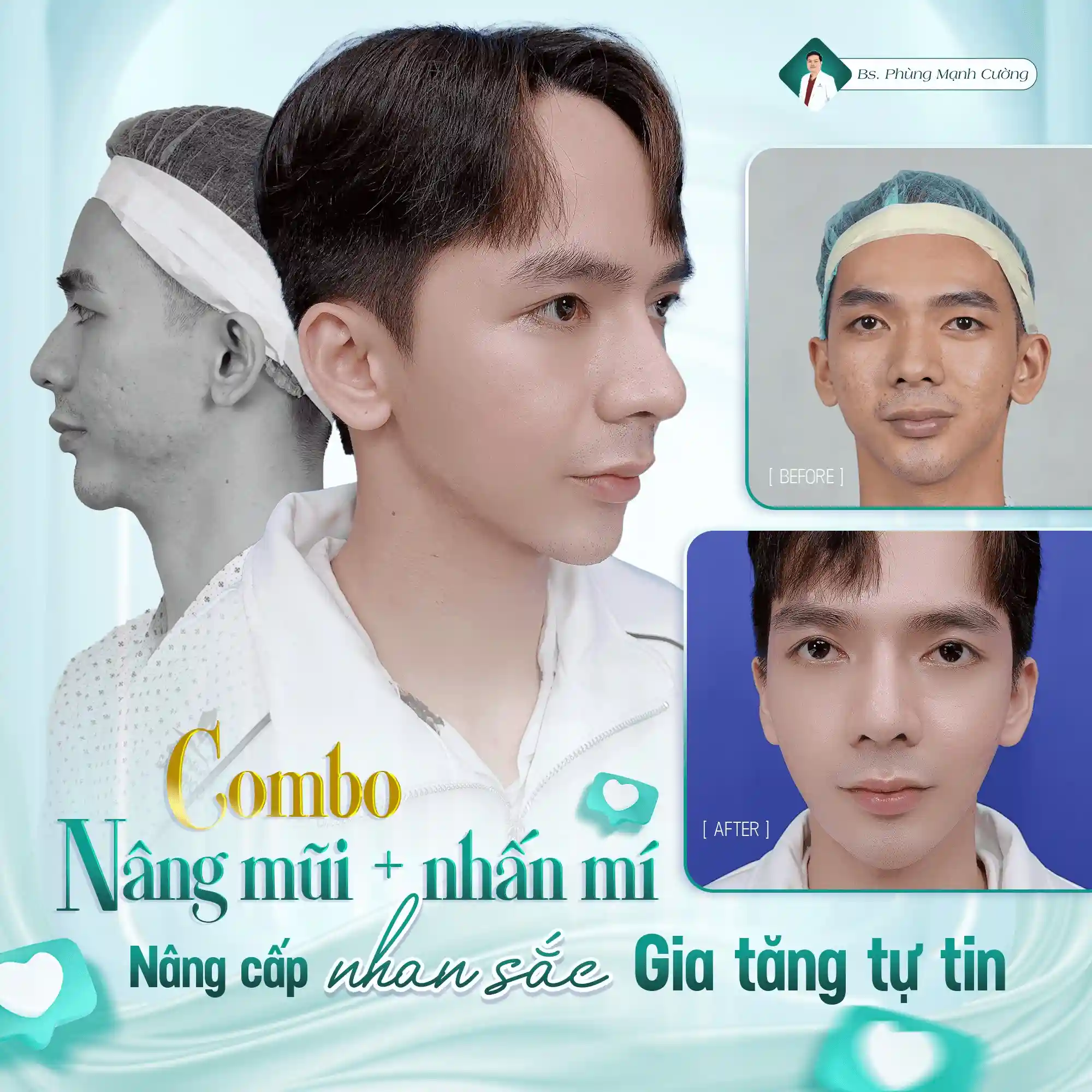 Ưu điểm của kỹ thuật bấm mí Hàn Quốc