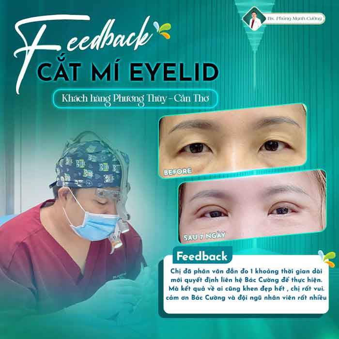 cat mi eyelid 1