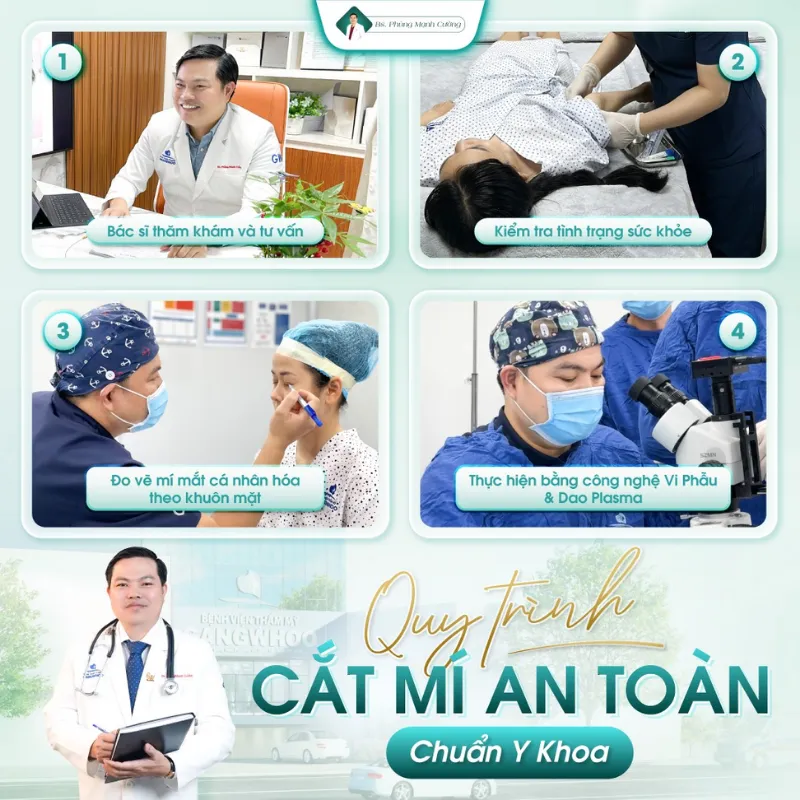 Phẫu thuật cắt mí eyelid là gì? Cắt mí eyelid giá bao nhiêu? 27 Quy trình cắt mí eyelid bài bản, chuẩn y khoa