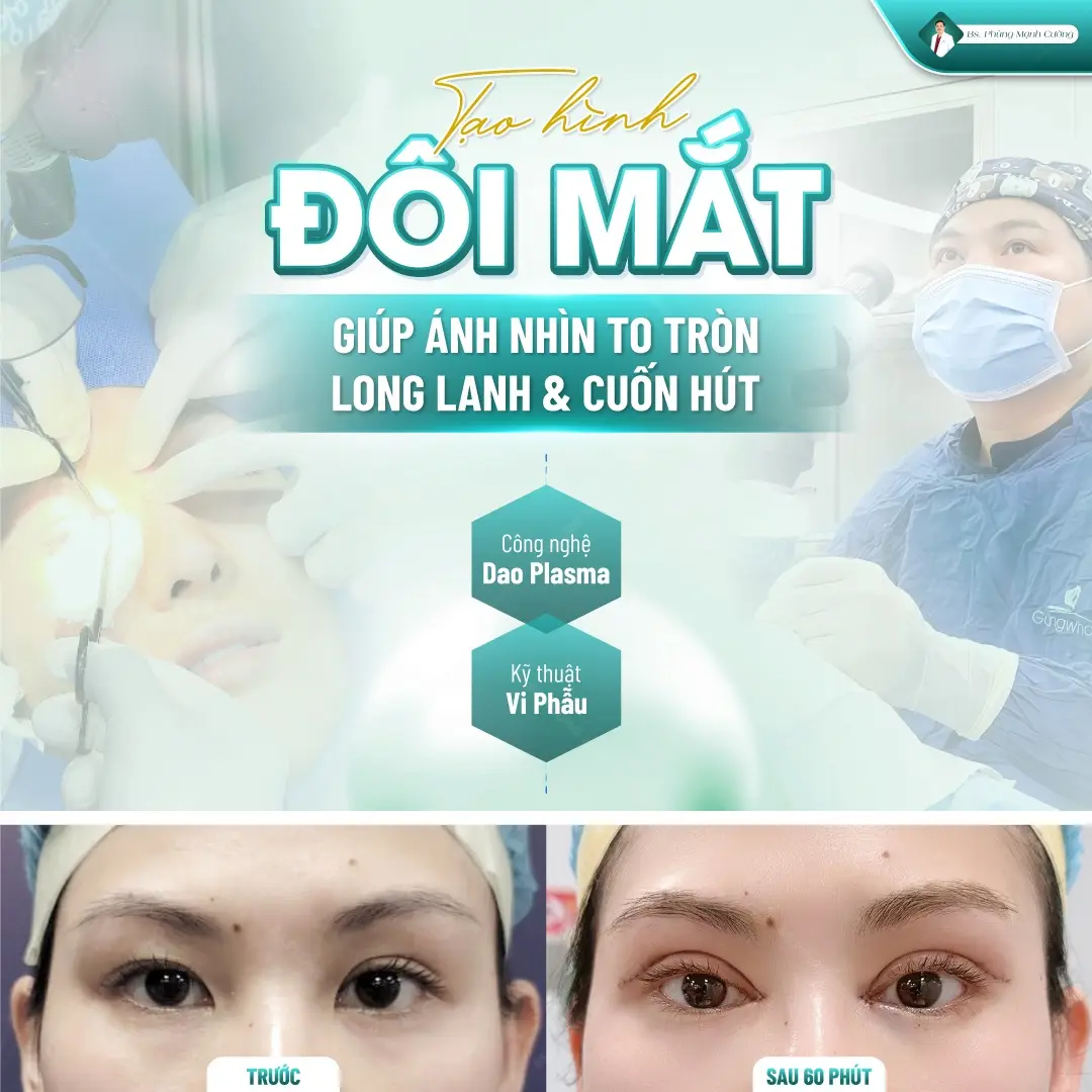 Cắt mí eyelid được thực hiện bằng công nghệ vi phẫu kết hợp dao mổ plasma hiện đại