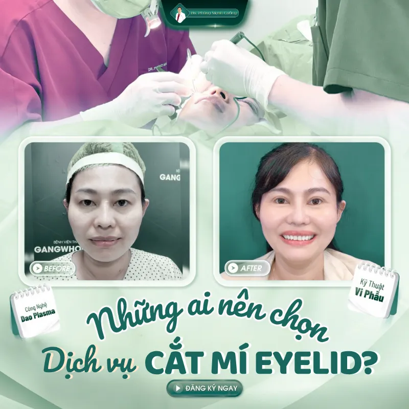 Phẫu thuật cắt mí eyelid là gì? Cắt mí eyelid giá bao nhiêu? 21 Tìm hiểu kỹ thuật cắt mí eyelid