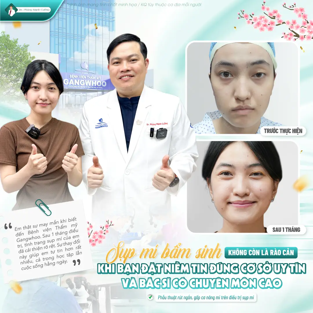 Dấu hiệu sụp mí cần phát hiện sớm