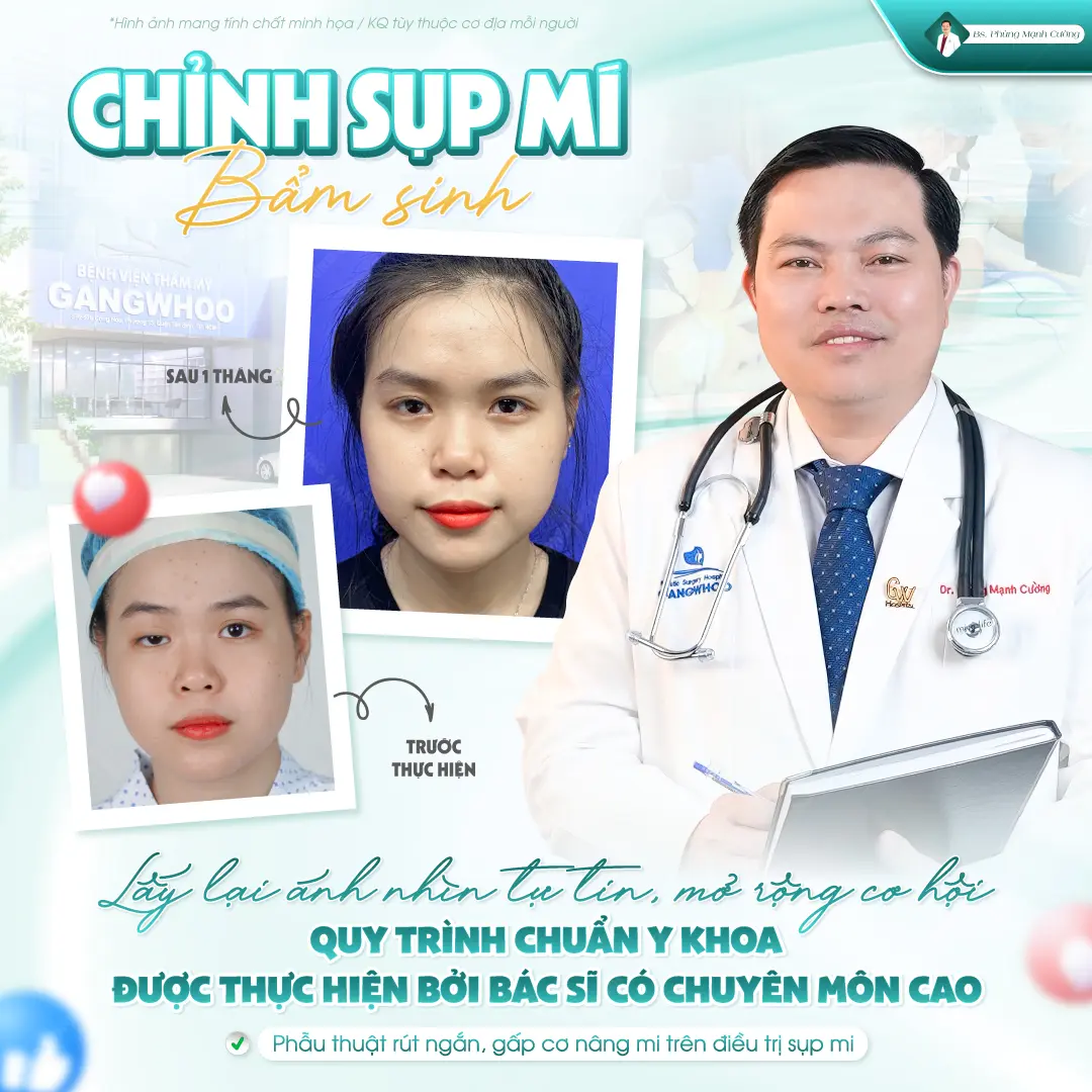 Phân biệt các mức độ sụp mí 