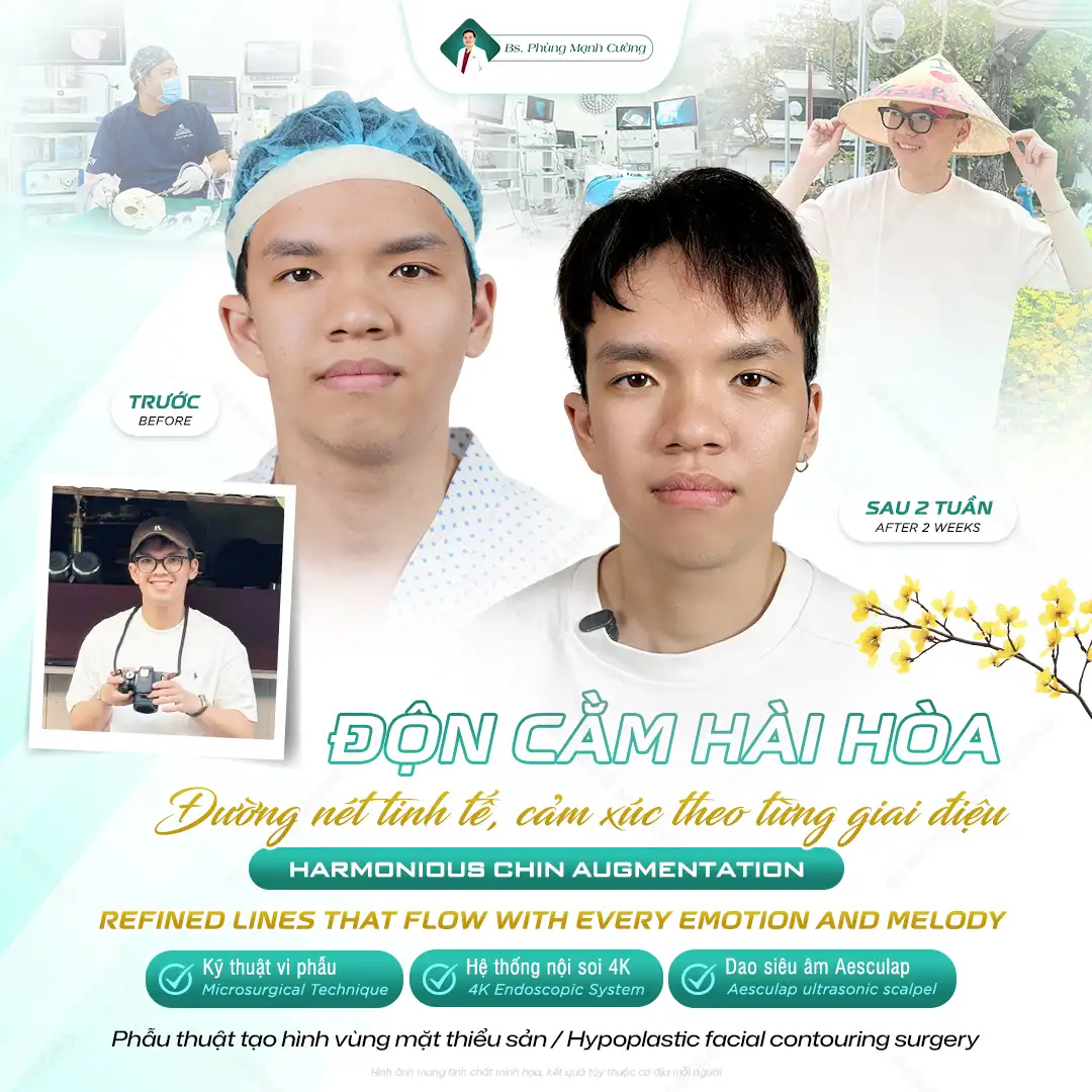 Đối tượng phù hợp với độn cằm