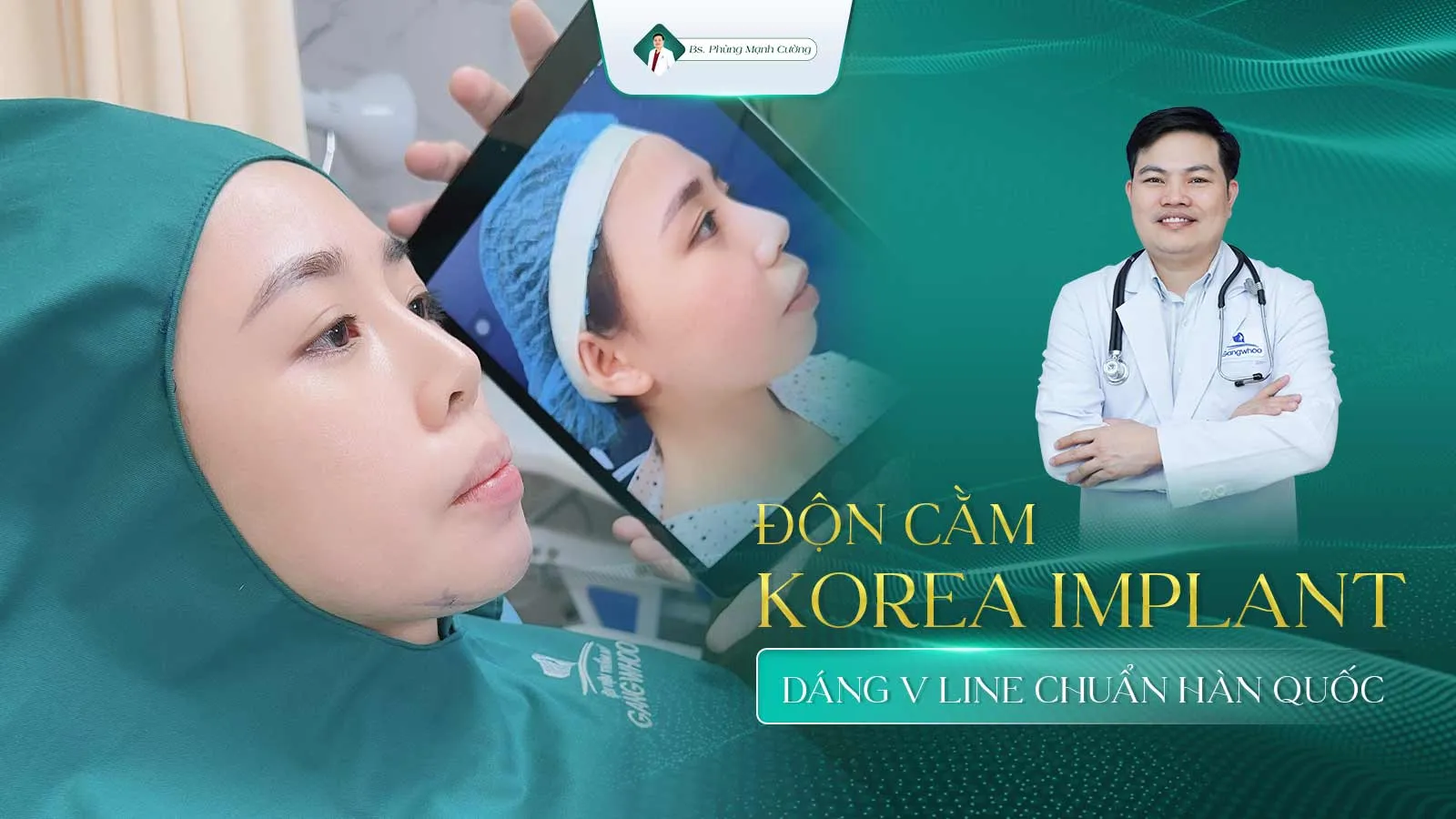 Độn Cằm (Korea Implant) Cho Mặt V-Line Đẹp Chuẩn "Sao Hàn"