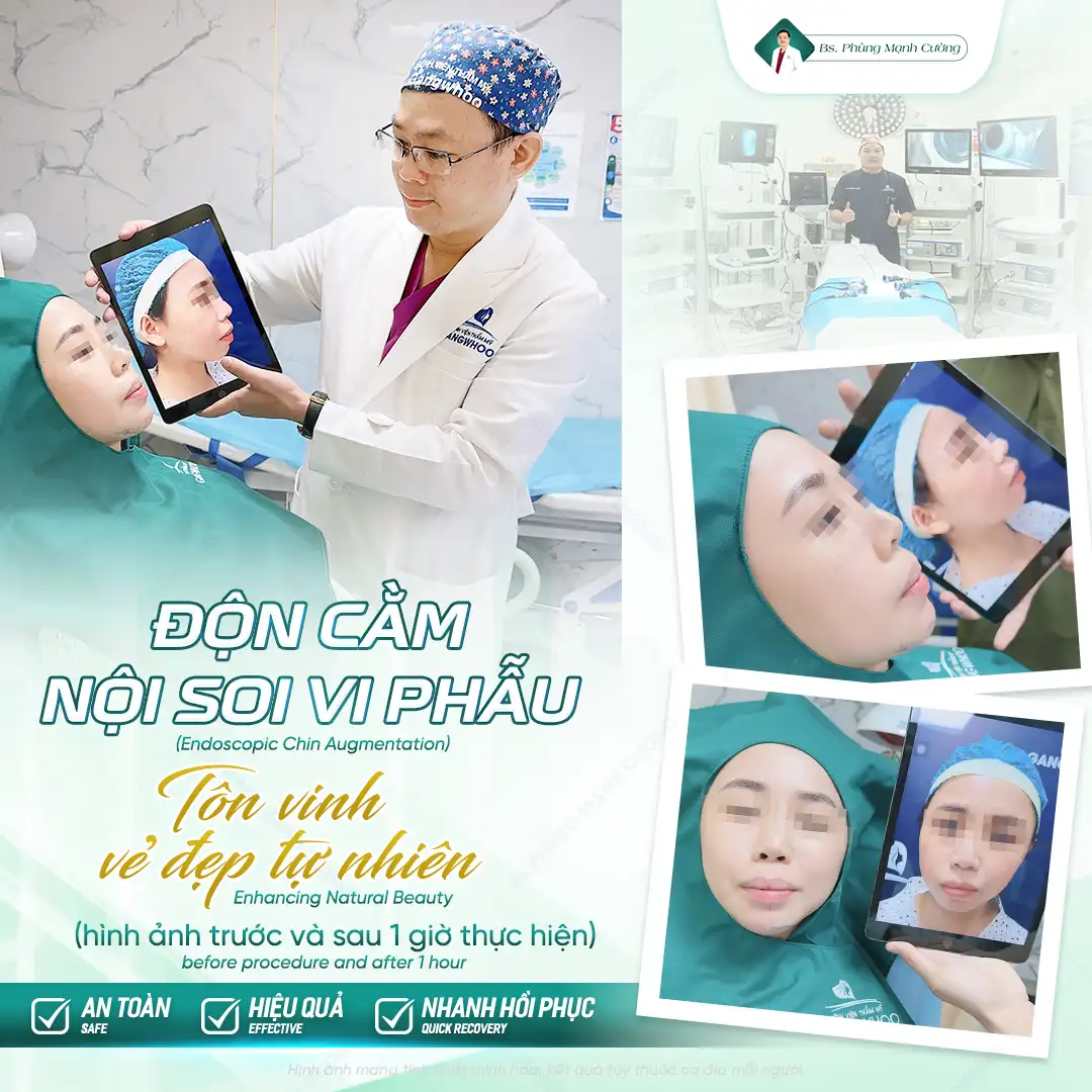 Ưu điểm của phẫu thuật độn cằm