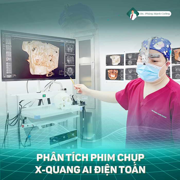X-Quang Ai điện toán giúp hỗ trợ BS Cường sửa mũi hỏng