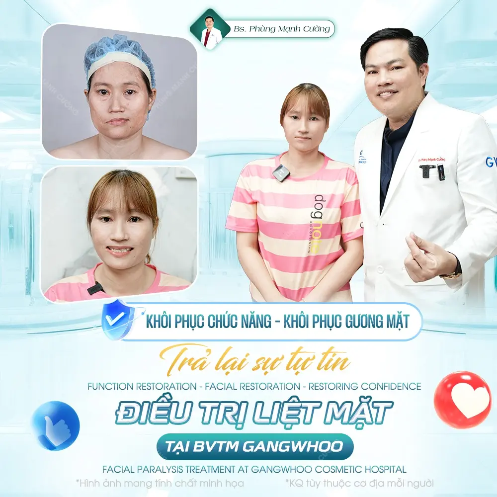 Chữa liệt mặt bằng cân cơ đùi tại bác sĩ Phùng Mạnh Cường
