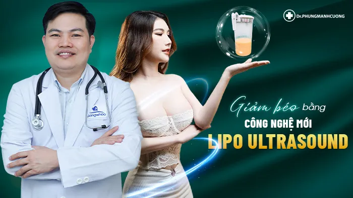 Giảm béo bằng Lipo Minfat
