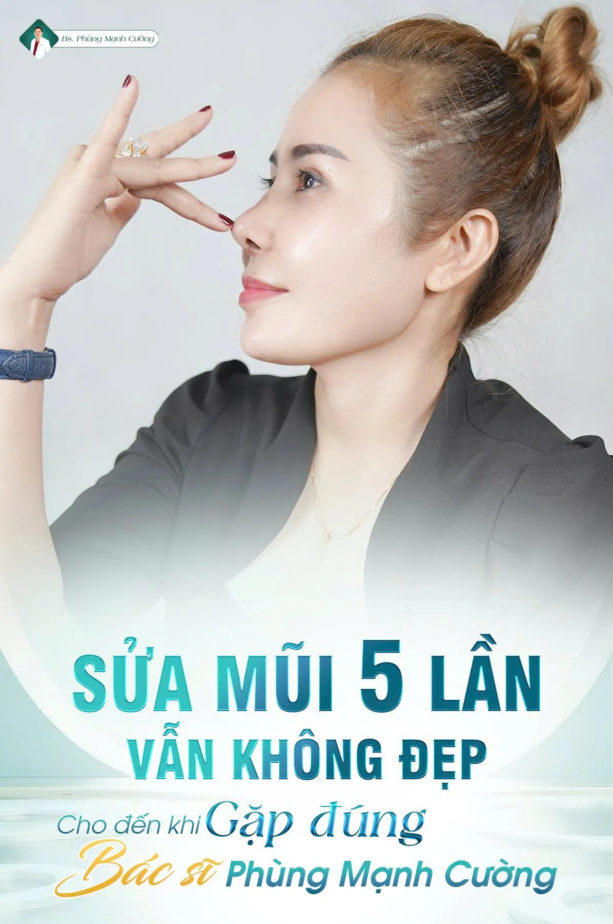 Phẫu thuật nâng mũi là gì? Chi phí và những lưu ý cần biết