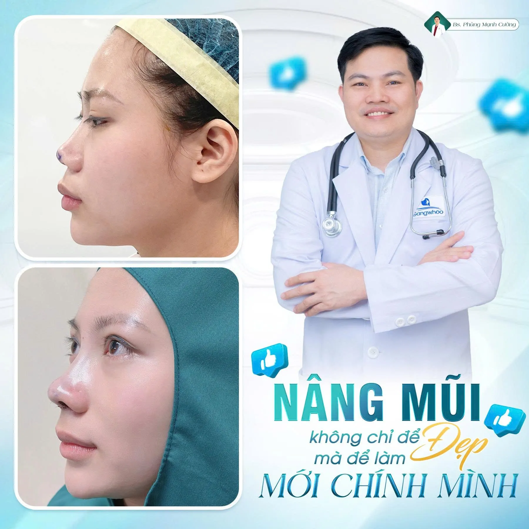 Phẫu thuật nâng mũi là gì? Chi phí và những lưu ý cần biết