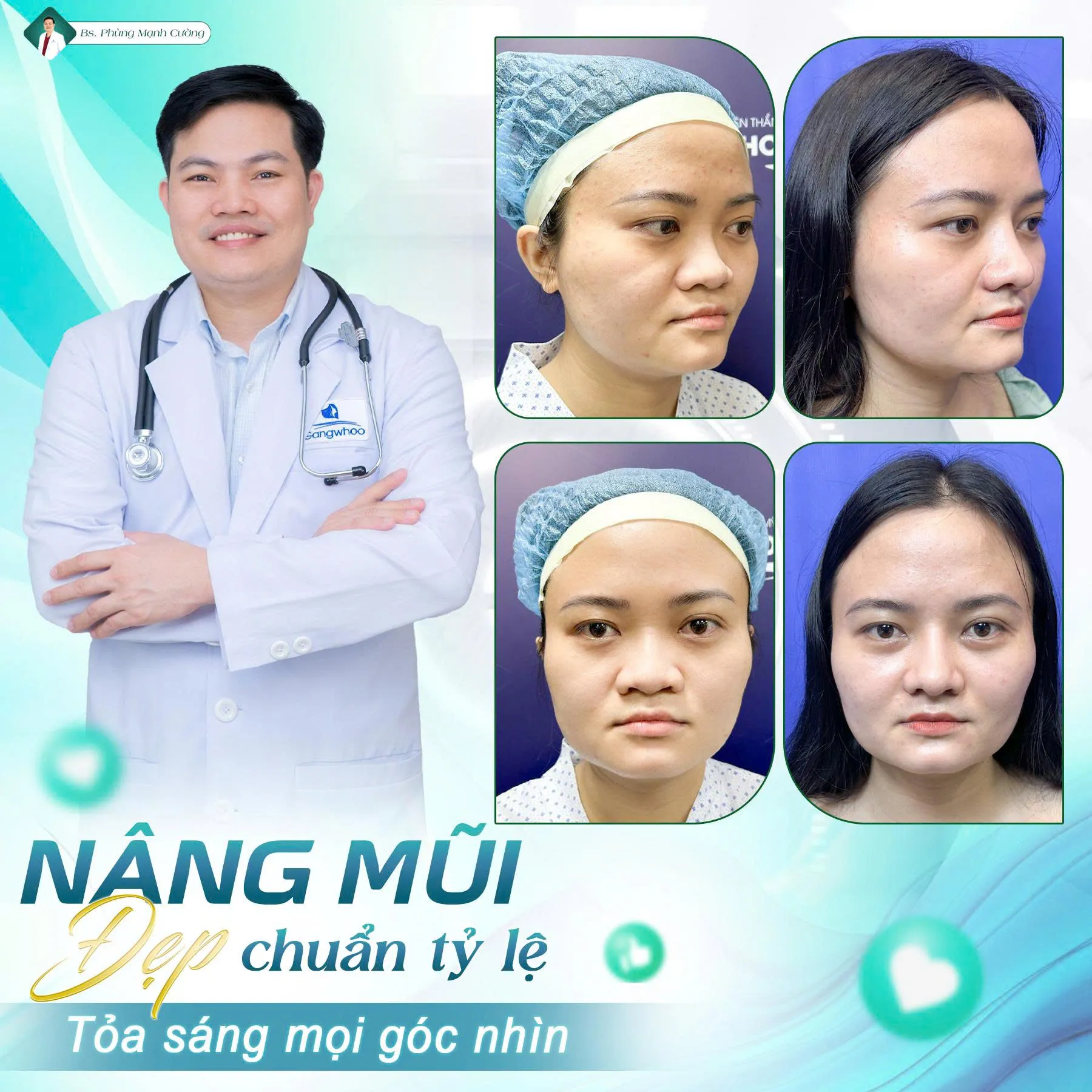 Những trường hợp nên nâng mũi