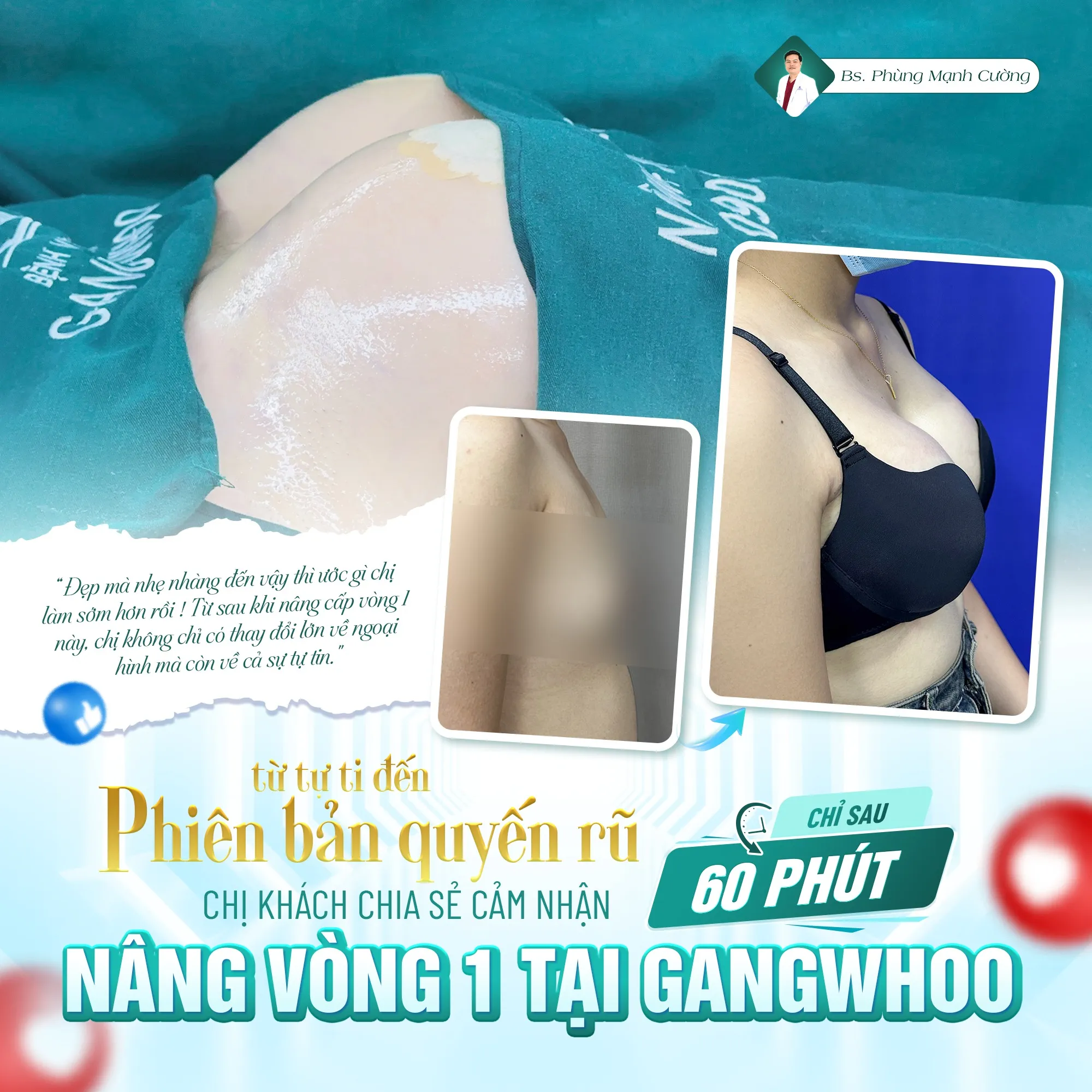 Nâng ngực bằng mỡ tự thân là gì? Có hiệu quả không? 33 Nâng Ngực Bằng Mỡ Tự Thân – Bí Quyết Vòng 1 Căng Tròn Không “Phẫu Thuật”