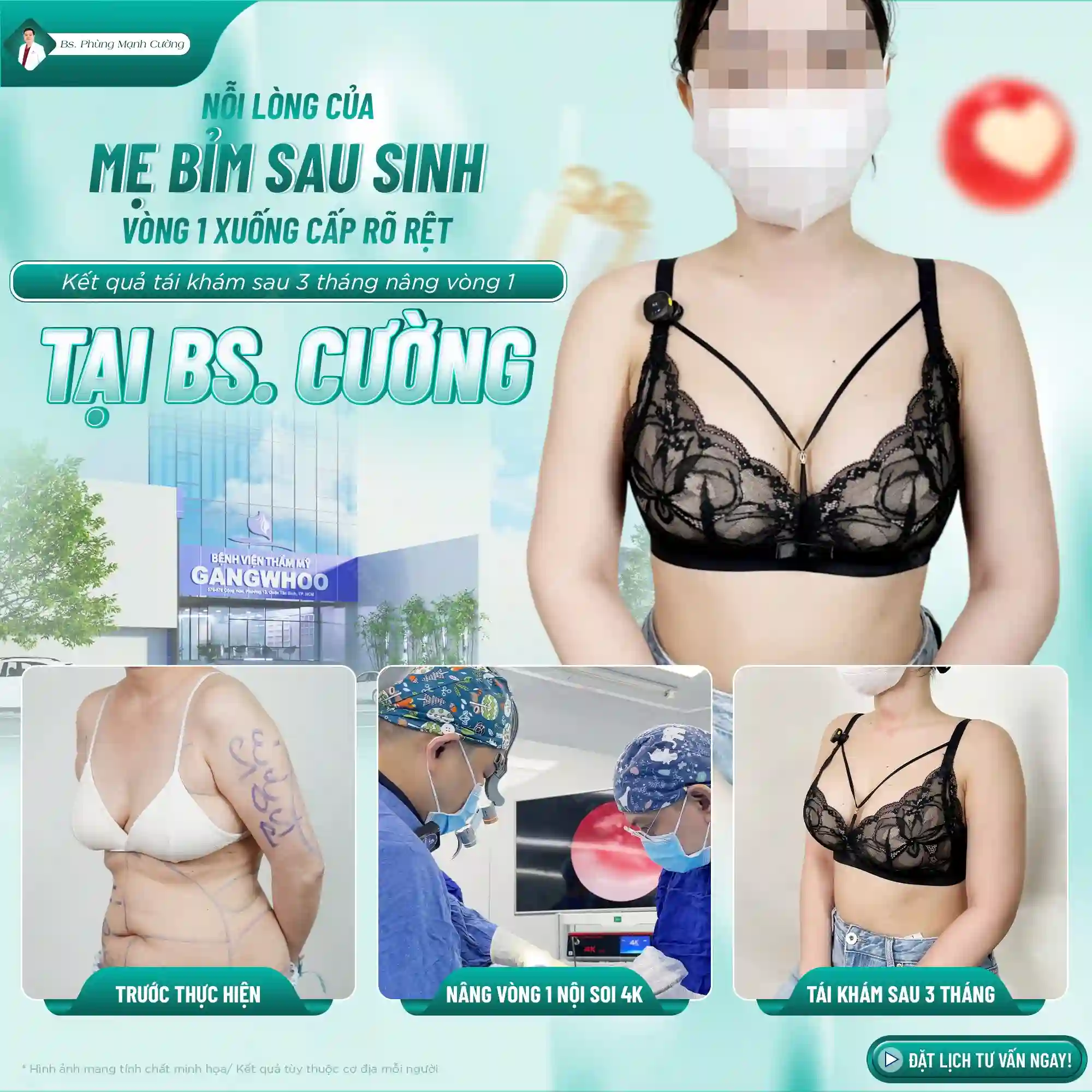 Những đối tượng phù hợp với treo ngực sa trễ