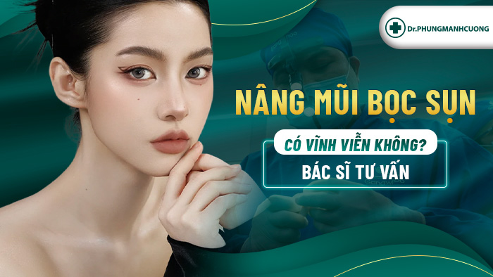 Nâng Mũi Bọc Sụn Có Vĩnh Viễn Không Bác Sĩ Tư Vấn