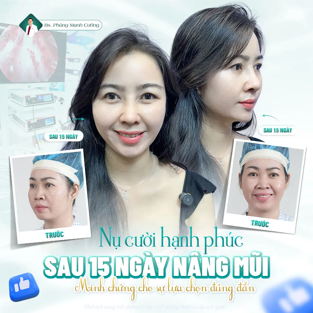 Ưu tiên lựa chọn cơ sở có đội ngũ bác sĩ có chuyên môn cao, nhiều năm kinh nghiệm