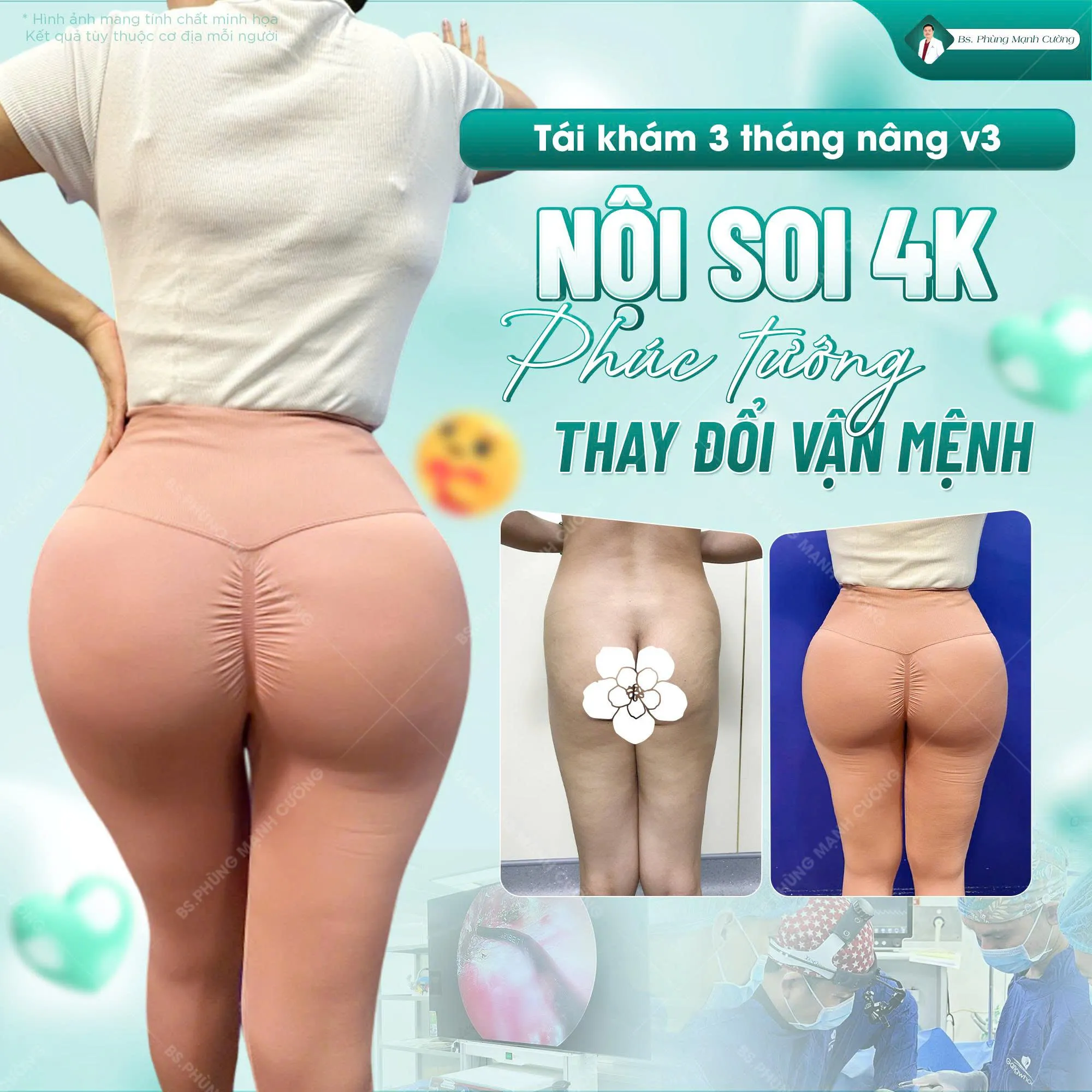 Các tiêu chí đánh giá cơ sở nâng mông uy tín