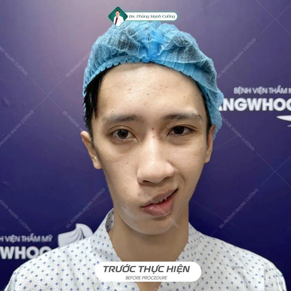 Liệt Dây Thần Kinh Số 7 Lâu Năm Có Chữa Khỏi Không?