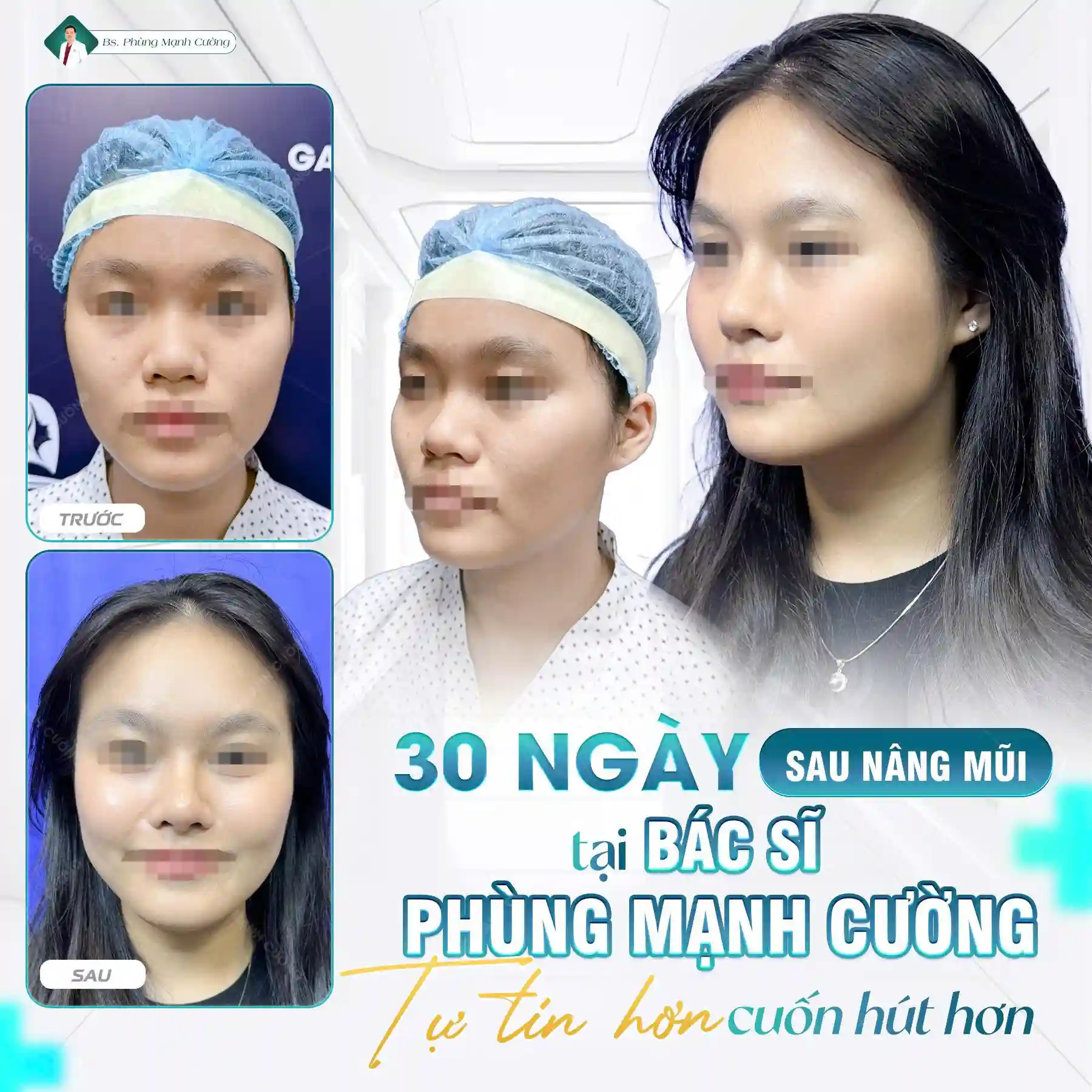 Nâng mũi bao lâu thì hết sưng? Cách giảm sưng sau nâng mũi 9 Tuân thủ chỉ dẫn của bác sĩ để giảm sưng hiệu quả