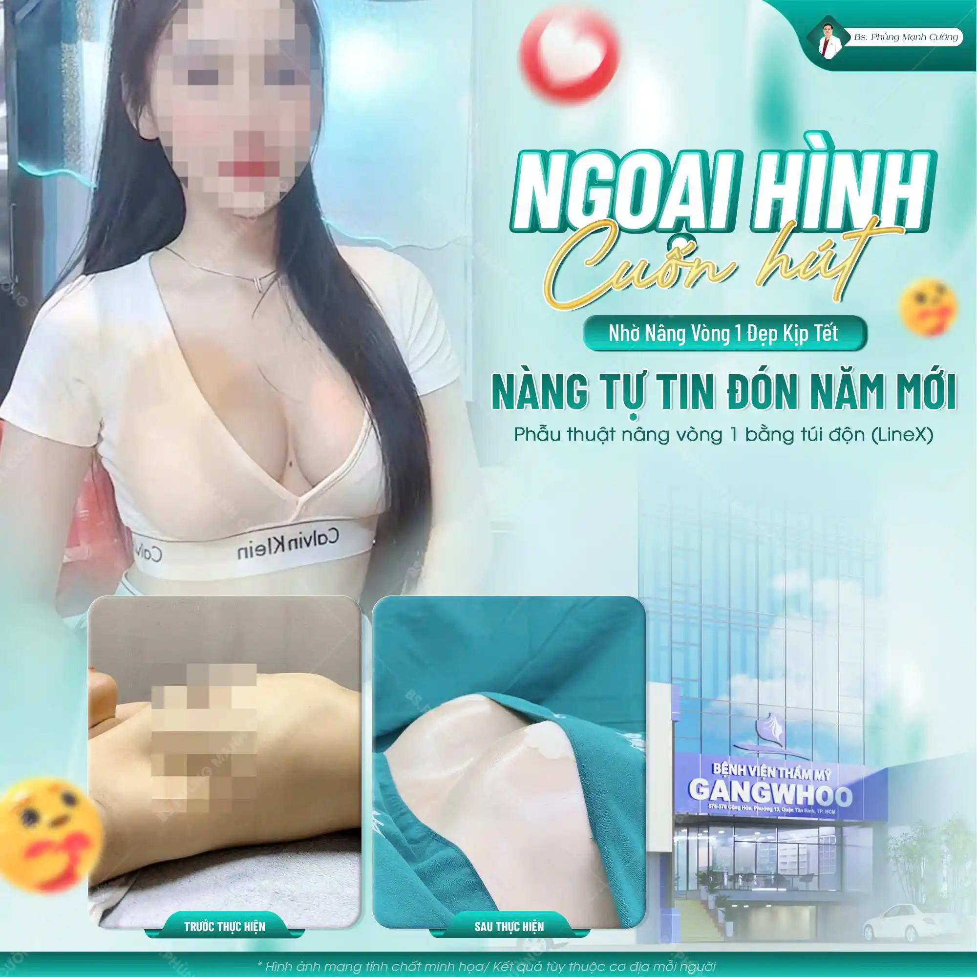 Tìm hiểu về nâng ngực qua đường nách