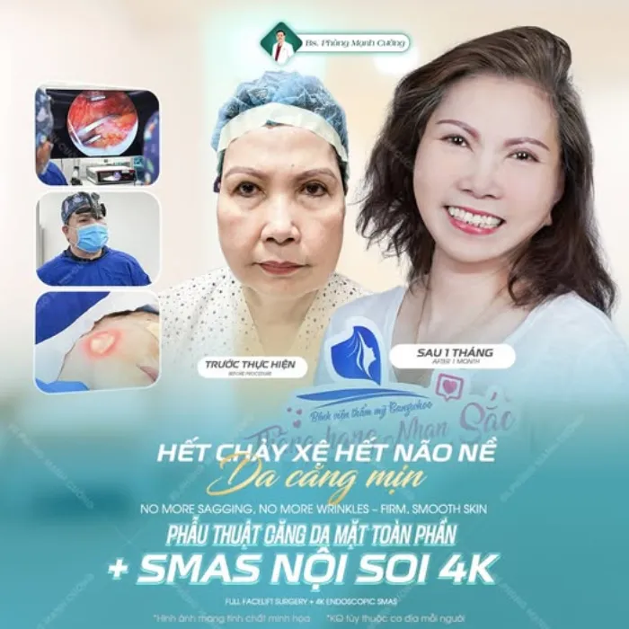 Căng Da Mặt (Perfect) Níu Giữ Thanh Xuân, Ngăn Chặn Lão Hóa