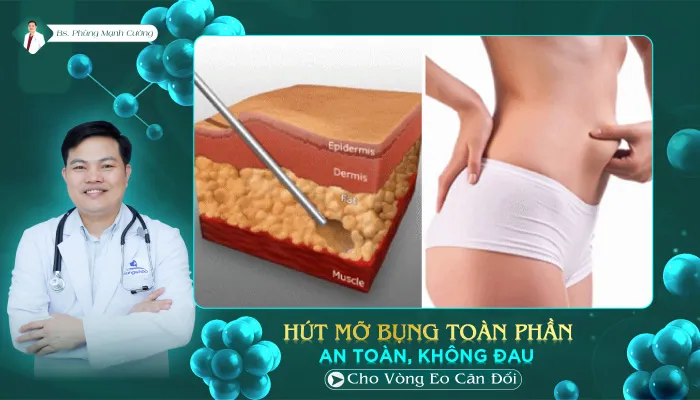 hut mo bung toan phan