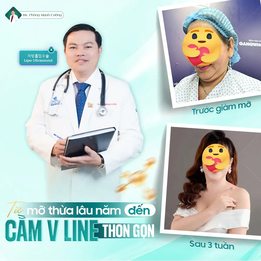 Hút mỡ nọng cằm an toàn tại bác sĩ Phùng Mạnh Cường