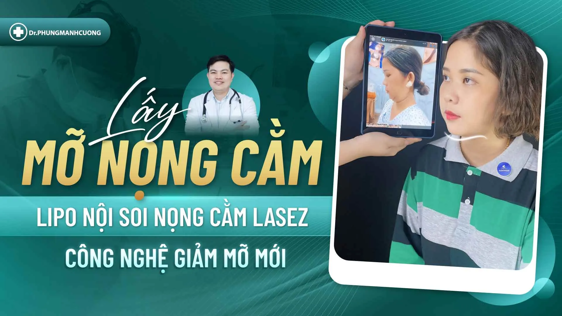 Lấy mỡ nọng cằm
