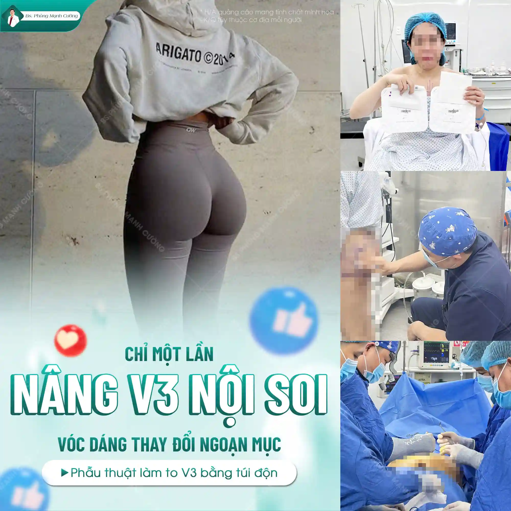 Ưu điểm của túi ergonomix 