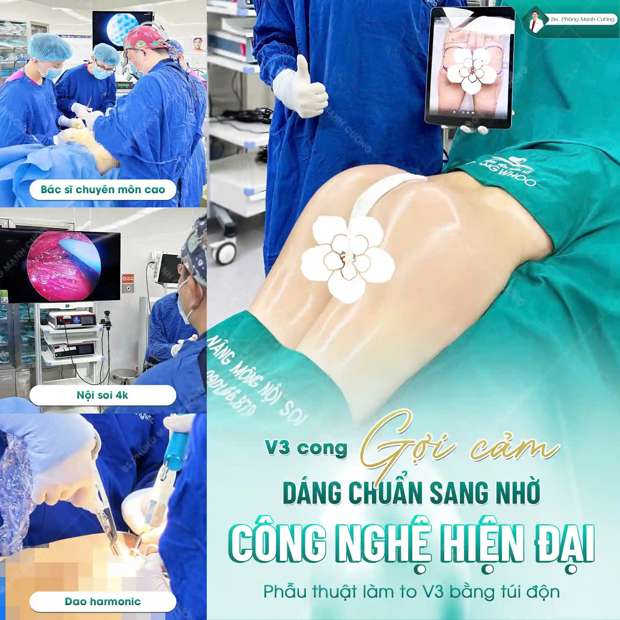 Túi độn Ergonomix có độ bền và tuổi thọ rất cao