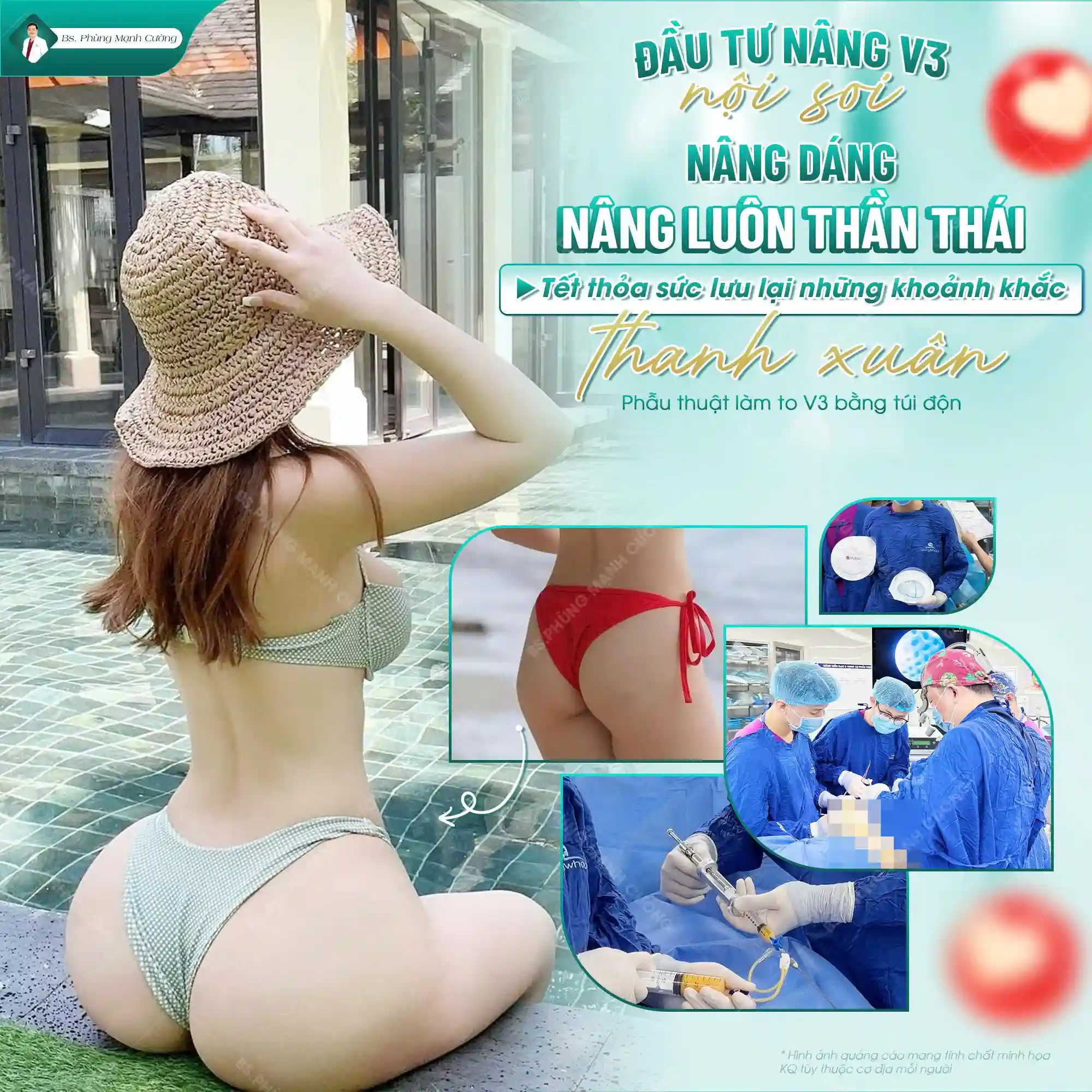 Nâng Mông Bằng Túi Ergonomix Khắc Phục Vòng 3
