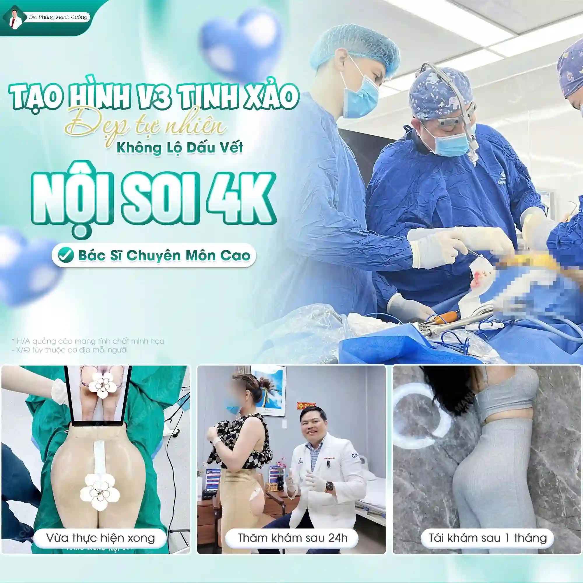 Nâng mông nội soi là gì? Những ai nên nâng mông nội soi?