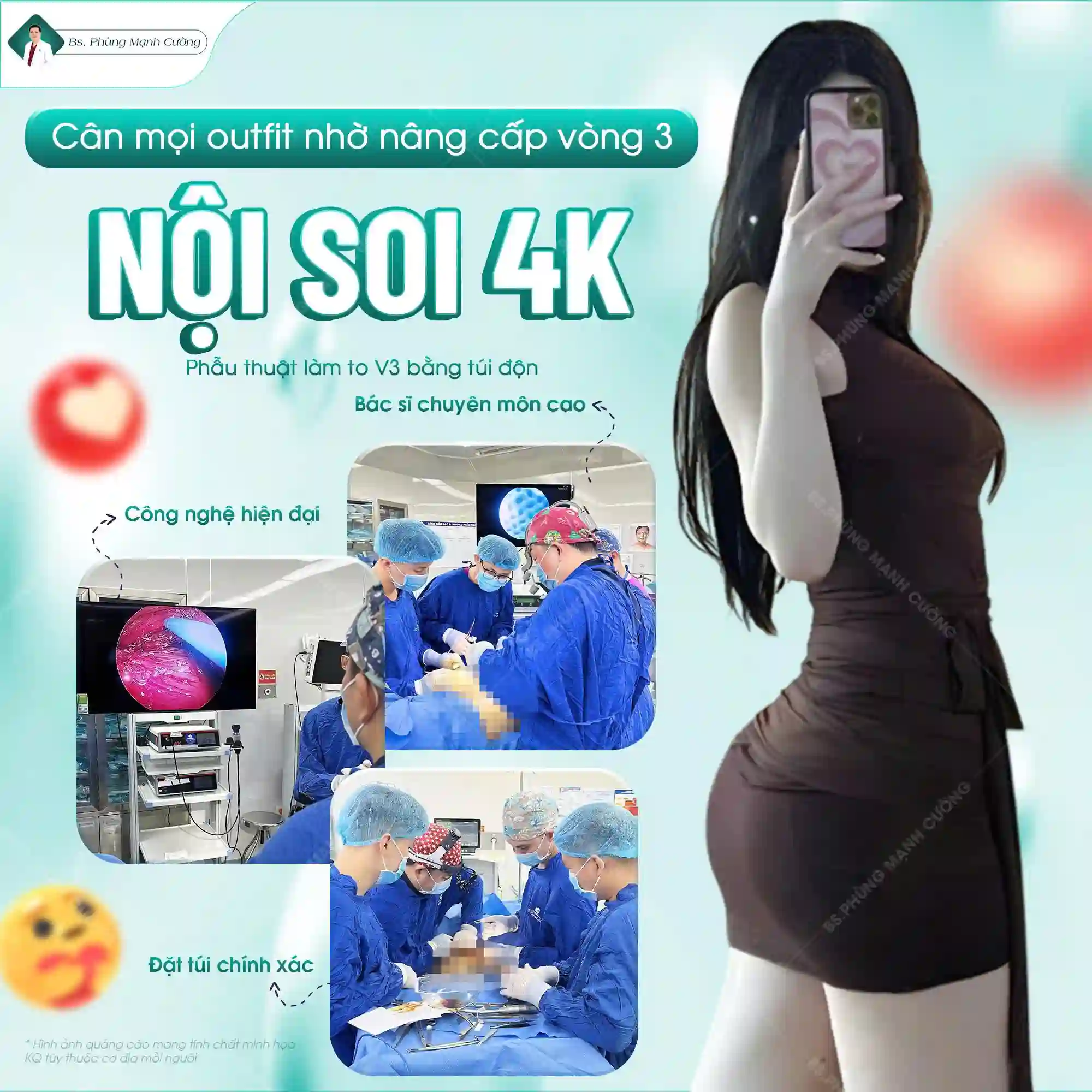 Nâng mông nội soi là gì? Những ai nên nâng mông nội soi?