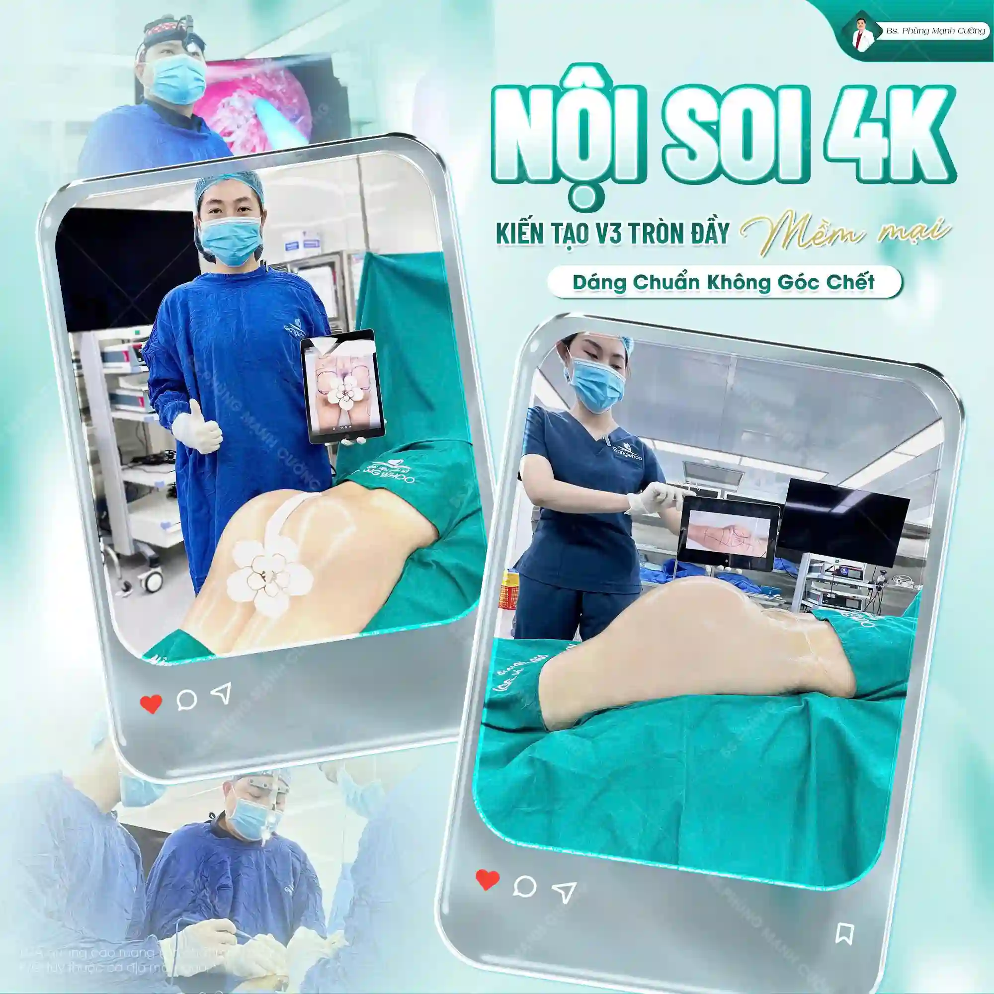 Ưu điểm khi thực hiện nâng mông nội soi 4K