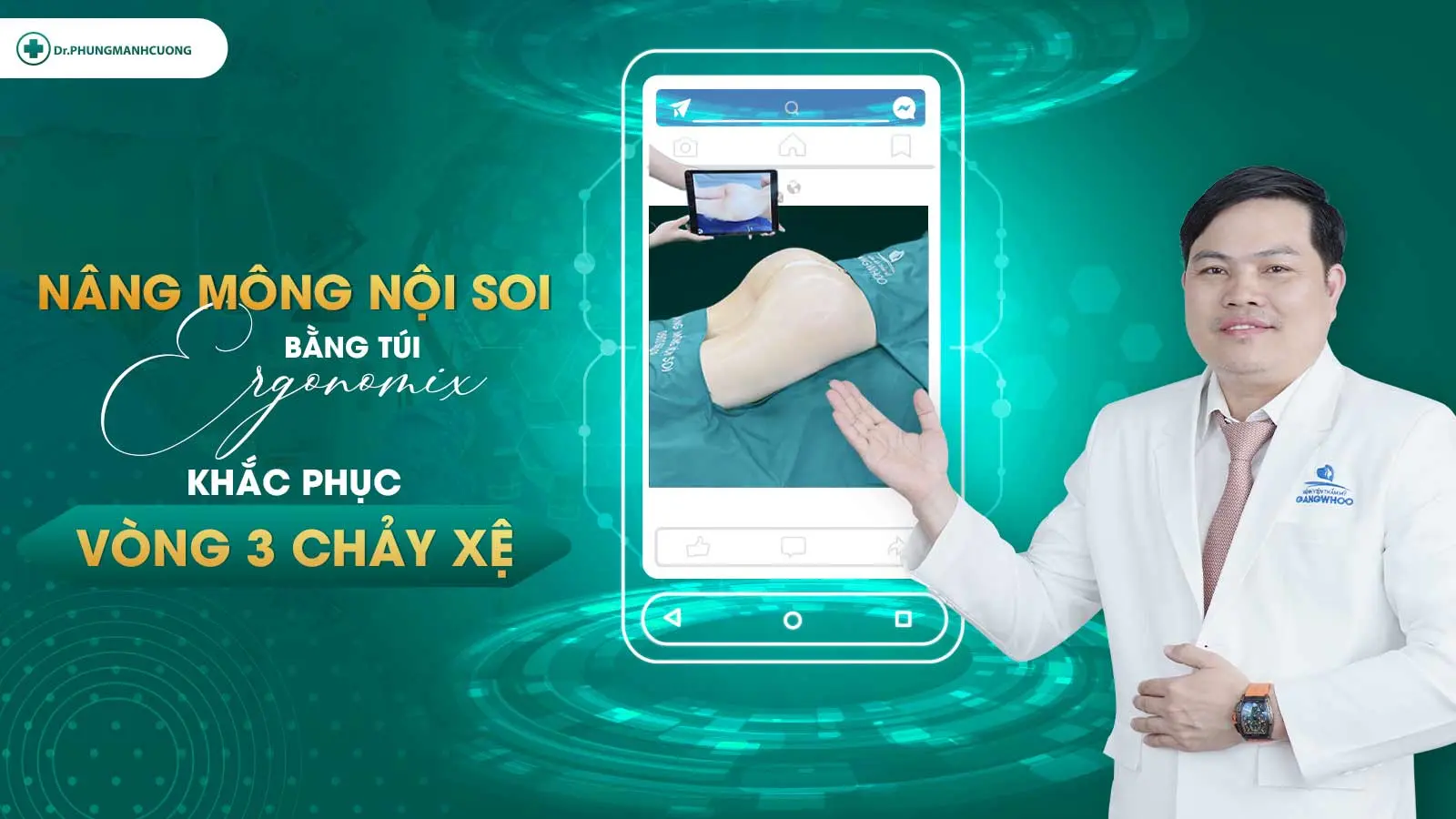 nang mong noi soi bang tui