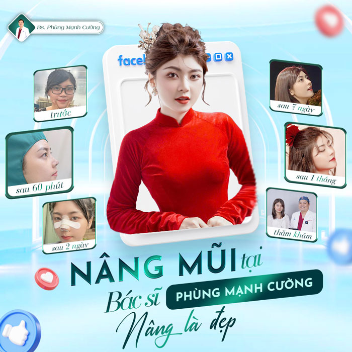 Nâng Mũi Cấu Trúc Có An Toàn Không?