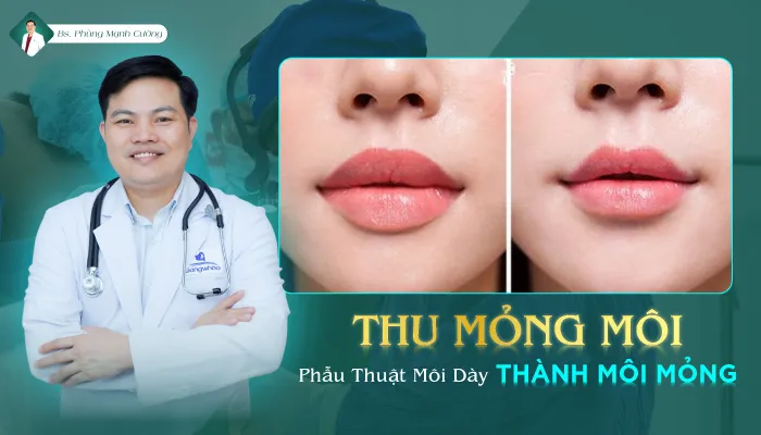 thu mong moi 1