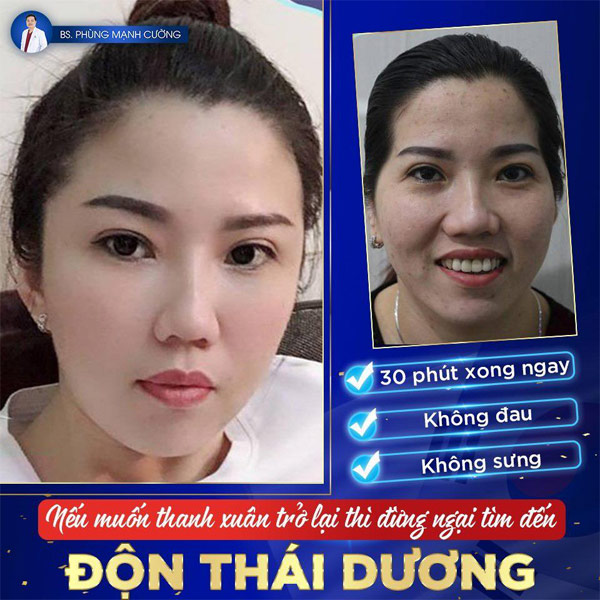 don thai duong 1