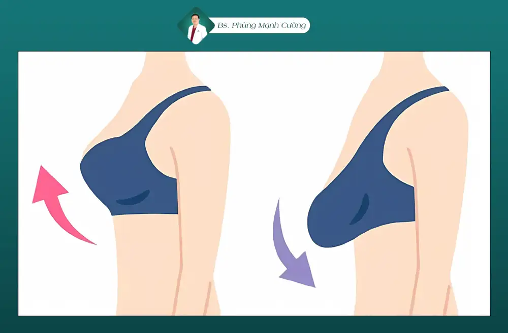 Nếu sử dụng máy massage ngực không đúng có thể gây tình trạng chảy xệ