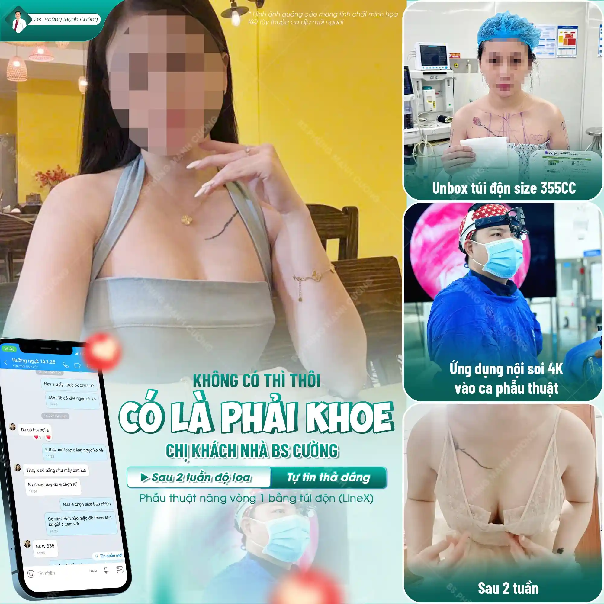 Nâng ngực bằng đường nách là một lựa chọn tốt và an toàn