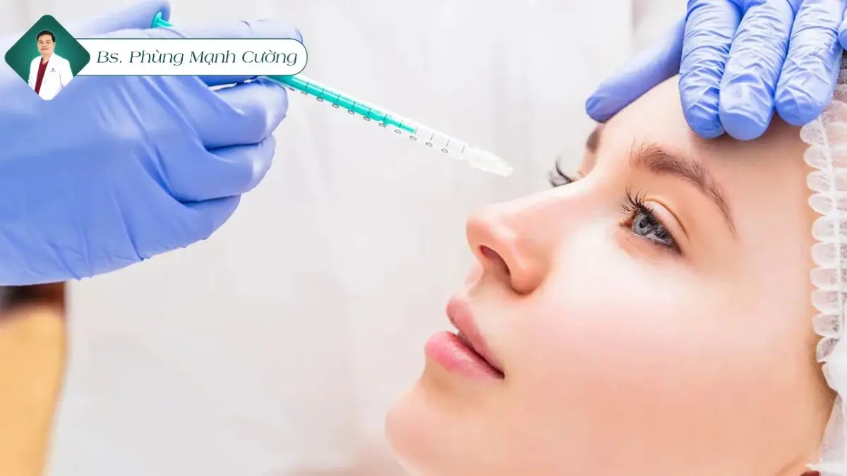 Nâng mũi bằng filler là gì? Có nên tiêm filler mũi không? 9 Tiêm fiiler nâng mũi