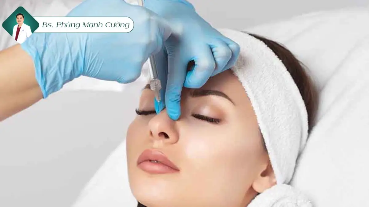 Nâng mũi bằng filler là gì? Có nên tiêm filler mũi không? 10 Có nên tiêm filler mũi không
