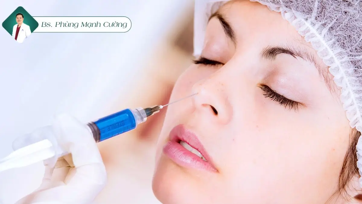 Nâng mũi bằng filler là gì? Có nên tiêm filler mũi không? 8 Tiêm filler mũi