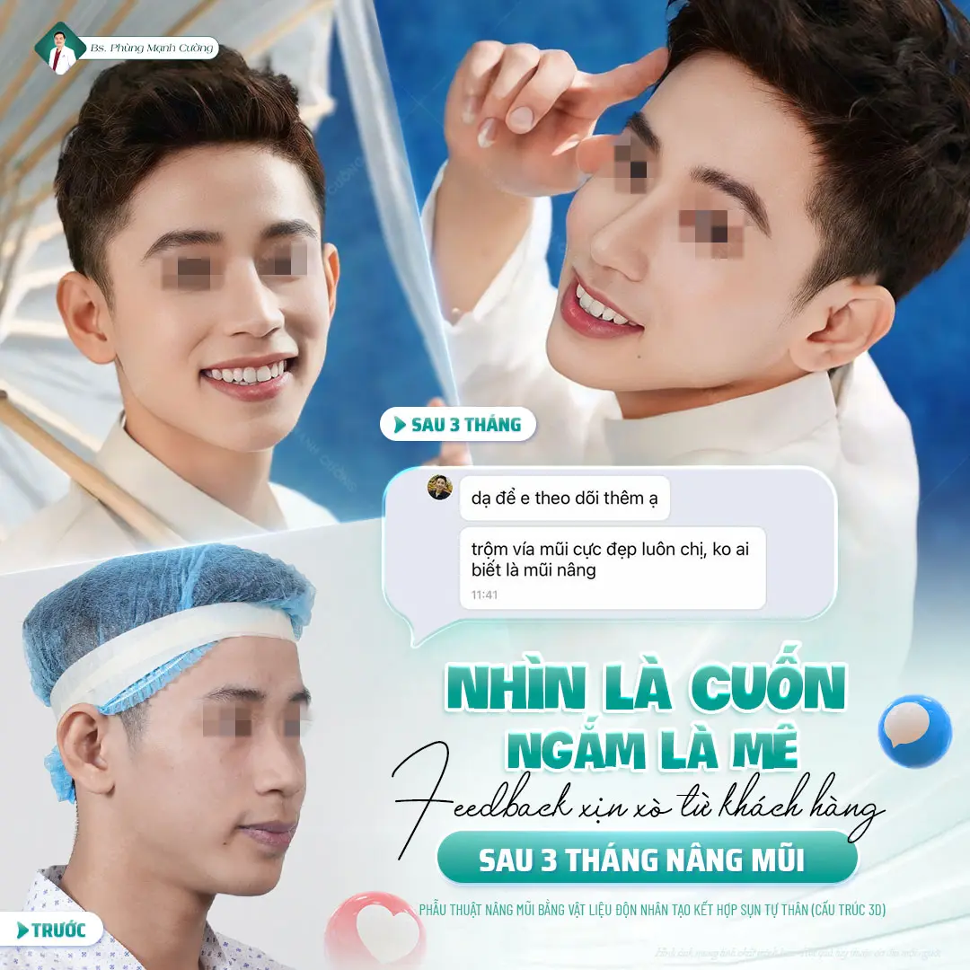 Đánh giá thực tế từ khách hàng nâng mũi tại bác sĩ Cường