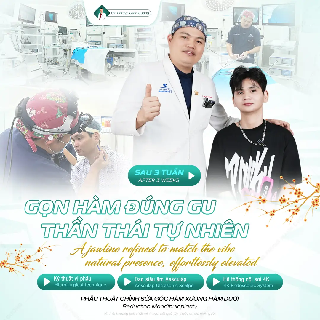 Chi phí phẫu thuật gọt hàm dao động từ 60 triệu đến 150 triệu đồng