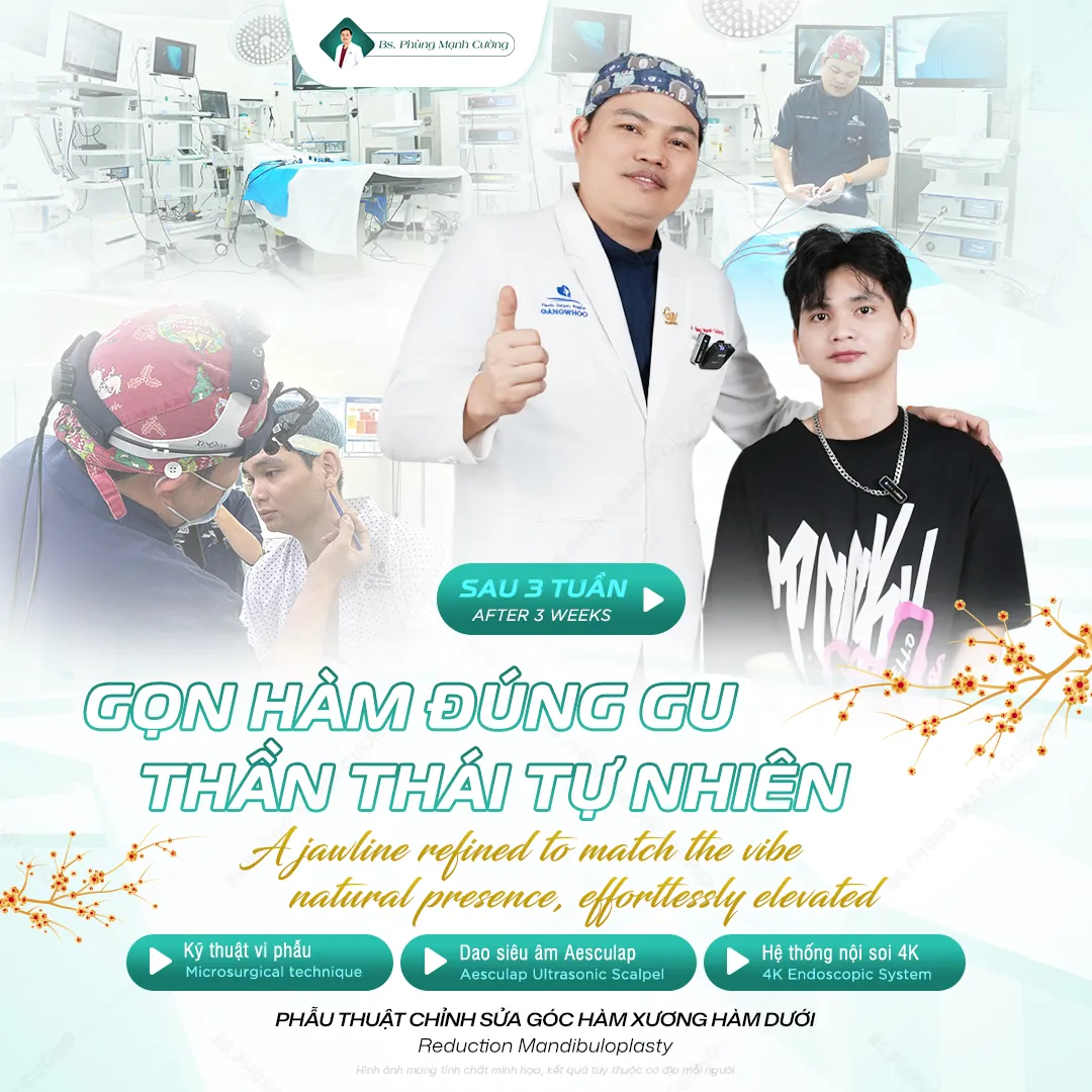 Quy trình gọt hàm từng bước chuẩn y khoa 15 Quy trình gọt hàm từng bước chuẩn y khoa