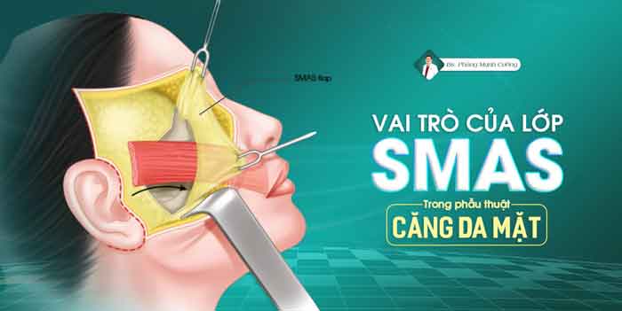 Vai trò của lớp Smas trong phẫu thuật căng da mặt