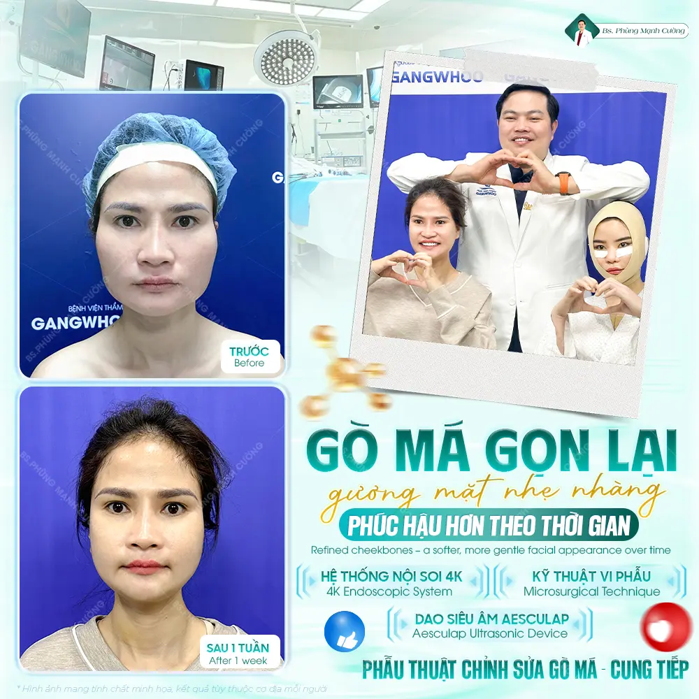 Trong lúc thực hiện hạ gò má khách hàng sẽ được gây mê nên sẽ không cảm thấy đau 