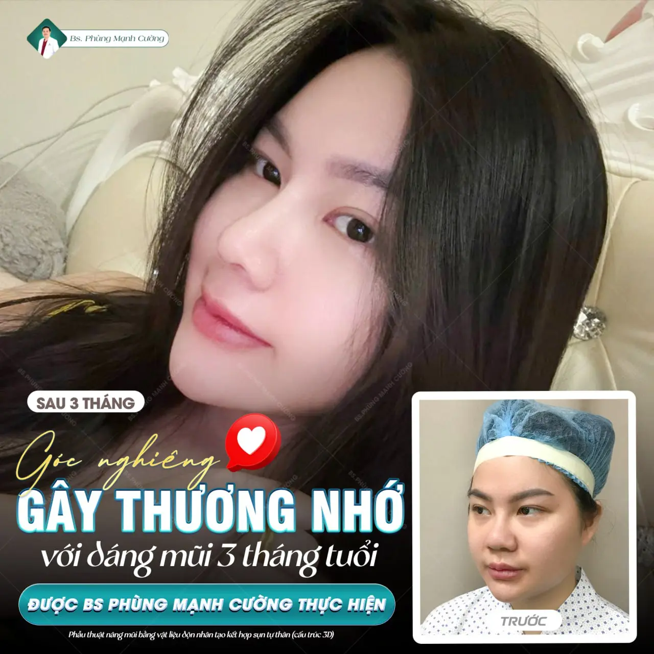 Một chiếc mũi đẹp giúp bạn thuận lợi trong công việc và cuộc sống