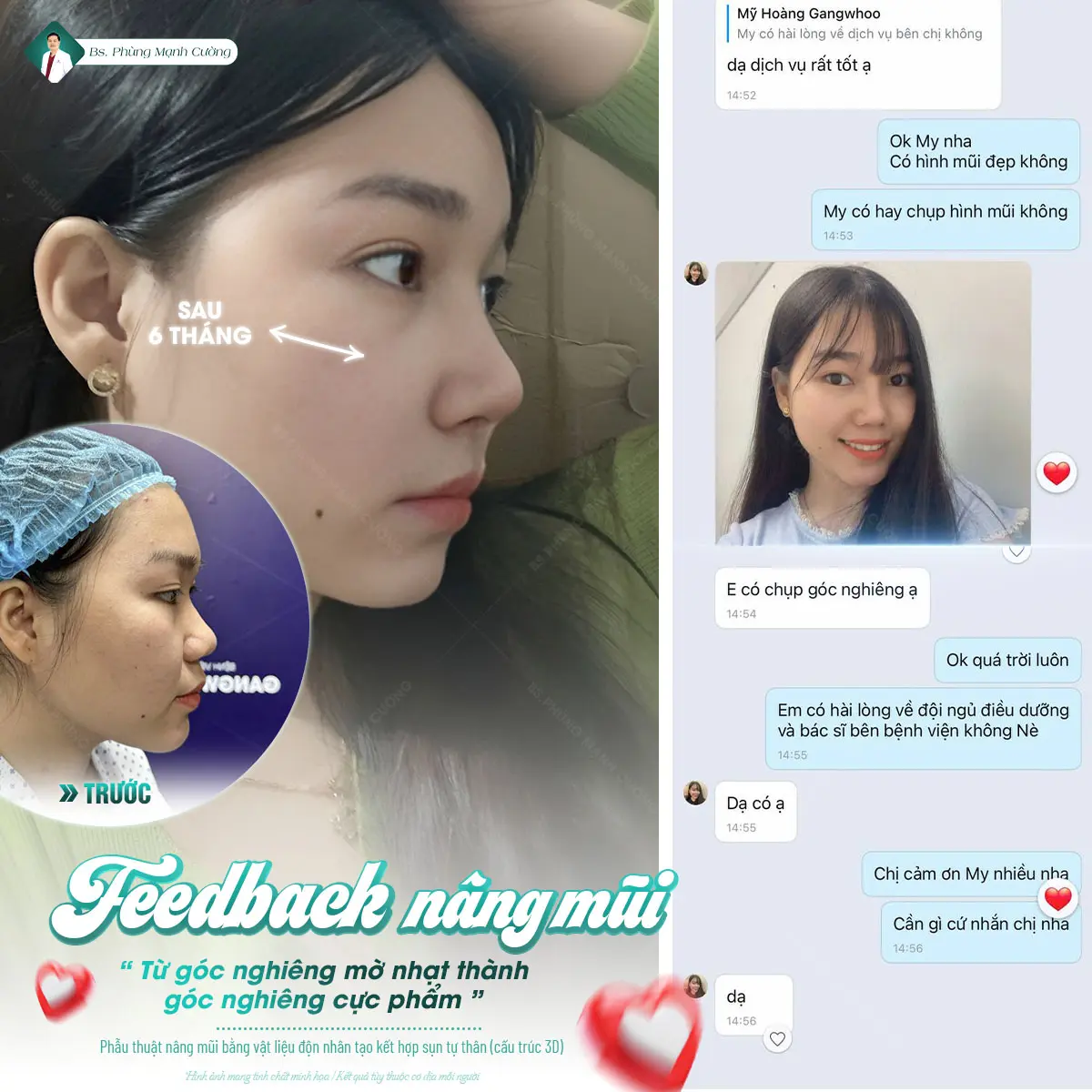 Dáng mũi cao đẹp có ảnh hưởng tích cực đến nhân tướng học